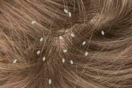 It is necessary to pay attention to the roots, there may be eggs of lice