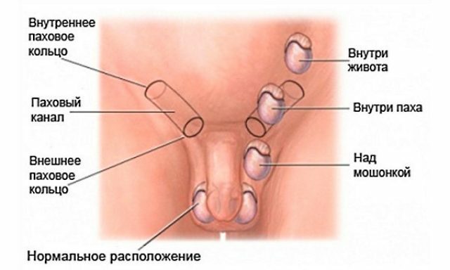 Hipogonadismul la bărbați, femei și copii: tipuri( primar, secundar, hipogonadotrop și altele), simptome, tratament și alte aspecte