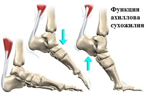 Achilles (Achilles) tendon. Where is on the leg, photo, anatomy
