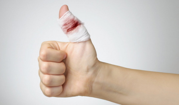 Jak zatrzymać krwawienie po skaleczeniu palca, po analizie
