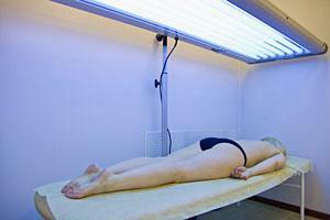 Ultraviolet irradiation( PUVA-therapy)