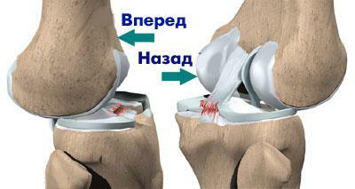 Mechanism of sprain and ligament rupture