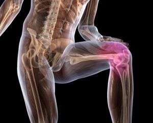 osteokondroza koljena