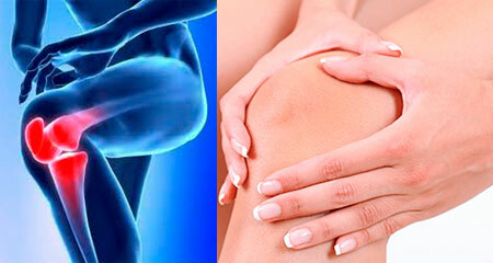 Signos de artritis de la articulación de la rodilla