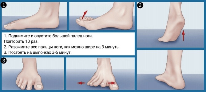 Fracture of the big toe. Symptoms, how much heals, how to cure, whether a plaster cast is needed, rehabilitation