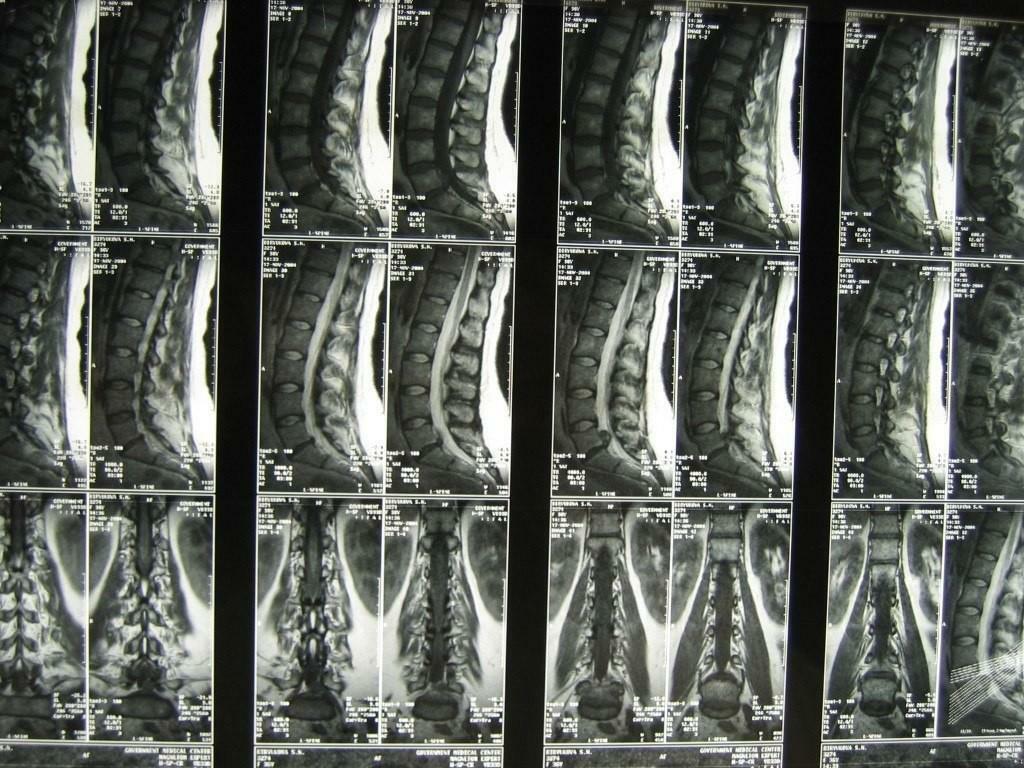 Funktionelles Röntgenbild