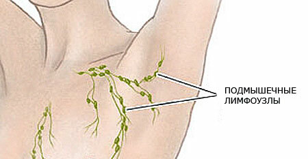 Inflammation and pain of lymph nodes under the arm