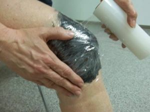 aplikasi tempurung lutut