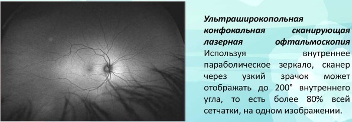 Ocular fundus. How to check what shows, norm, decoding