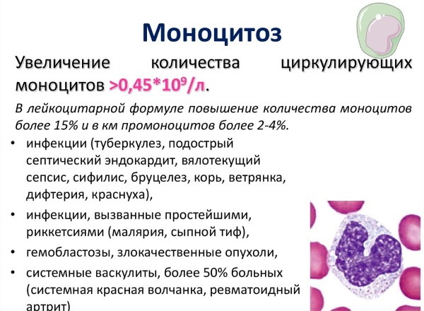Monocytose in het bloed. Wat is het, oorzaken, behandeling bij volwassenen