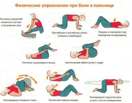 Physical exercises with intervertebral hernia
