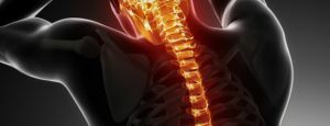 back pain with myelitis