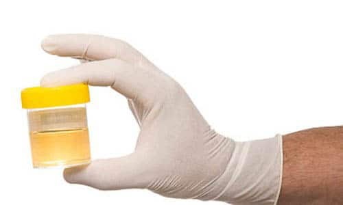 Why in the male urine there are impurities of mucus