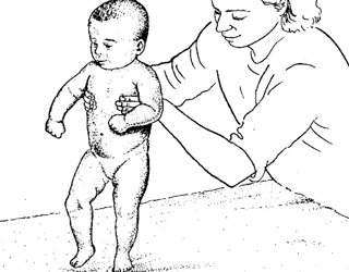 Syndrome von motorischen Störungen bei Neugeborenen