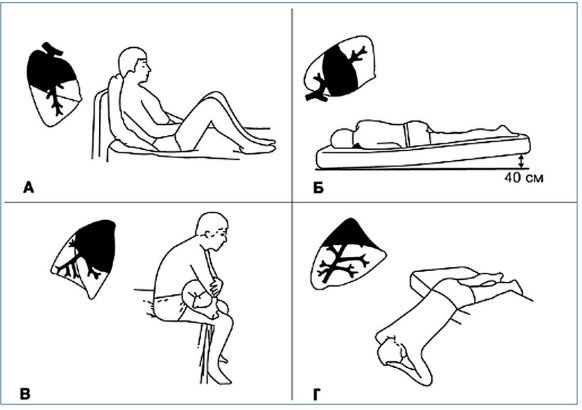 Drainase postural untuk anak di bawah satu tahun, 3-4-6-8 tahun. algoritma