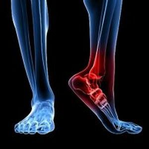 tendinitis van de voet