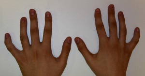 Mâinile înainte de operație