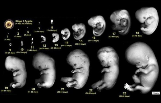 Stages of development of the human embryo