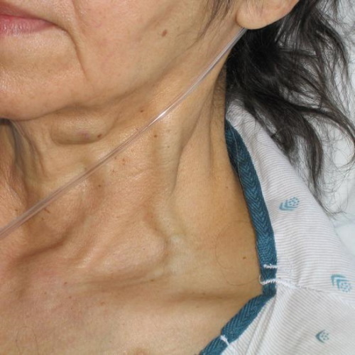 Jugular vein in the neck. Where is the person, photo