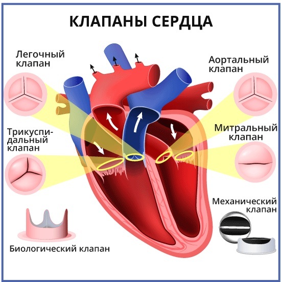 Damage to heart valves. What leads to disease, arrhythmia, myocardial infarction, angina pectoris