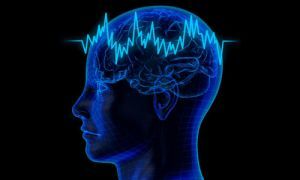 Epilepsi med centro-temporal adhæsioner