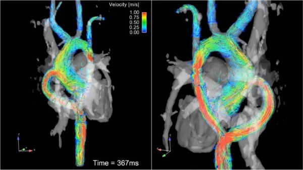 MRI av hjärtat. Vad visar det med och utan kontrast, hur görs det, vittnesbördet