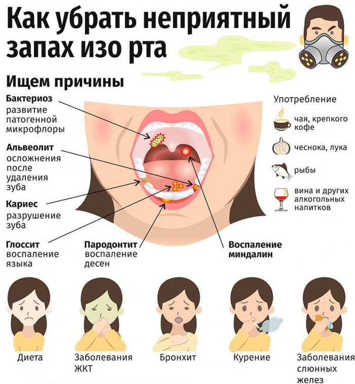 Supuvęs skonis burnoje, kvapas. Priežastys ir gydymas