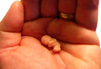 Potrat na začiatku tehotenstva