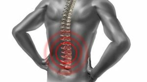 myelopathie van het ruggenmerg