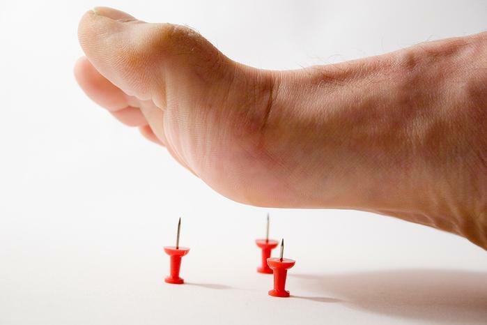 Complicações de pés planos longitudinais