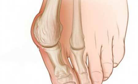 A bone on my leg aches near my thumb - what should I do?