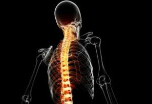 Inflammatory disease of the spine discitis