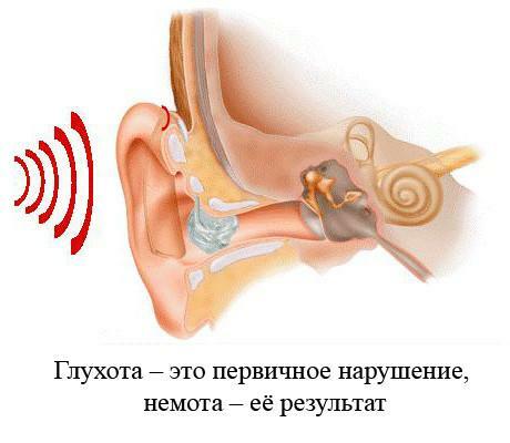 Gluhost je posledica otitisa