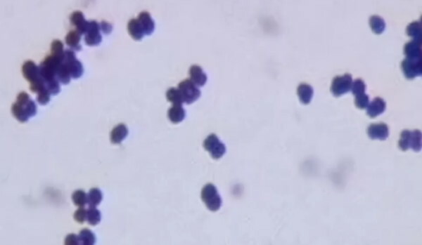 Cocci in a smear in men. What is it, the norm of gram cocci
