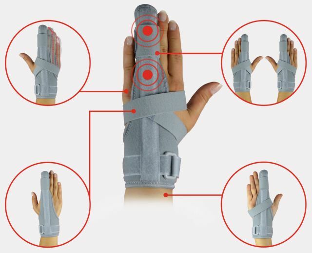 Fixoare pentru degete și degetele de la picioare - când aveți nevoie de o orteză și când anvelopa sau bandajul?