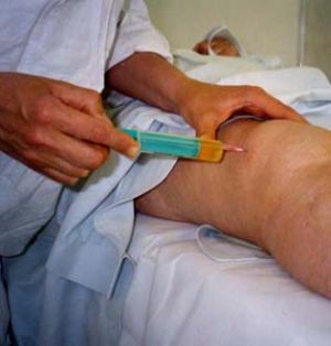 Puncția articulației genunchiului