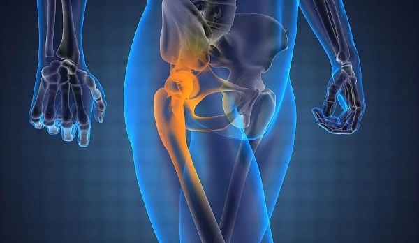 hip replacement. As extends, rehabilitation after surgery, whether laid disability
