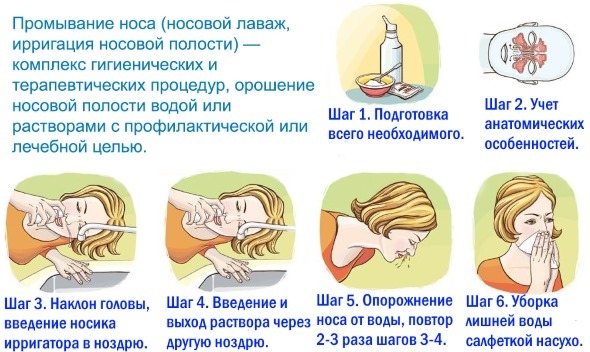 Løsning til nasal udskylning med rhinitis, bihulebetændelse, tilstoppet næse. Opskrifter til børn, voksne, graviditet