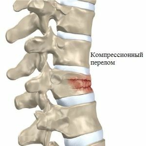 Injury of vertebrae