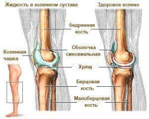 Un genunchi sănătos și dureros