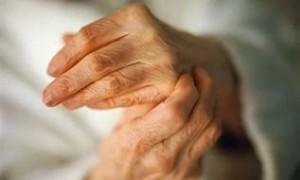 Tratamentul mâinii cu perie pentru artrita