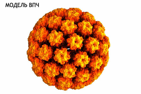 HPV - virusul papilloma la femei - tipuri, simptome și tratament