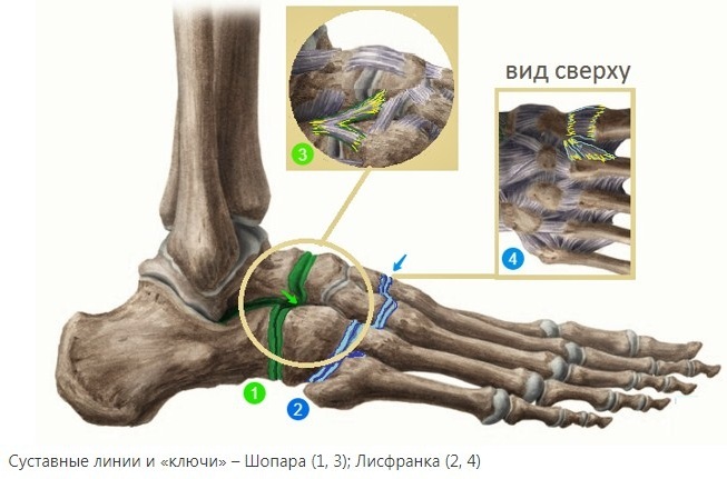 Chopard and Lisfranc joint. Anatomy, X-ray, ligaments, dislocation of the foot, osteoarthritis