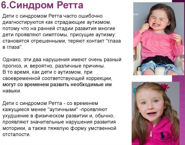 Rett syndrome in girls, children. What is it, symptoms, treatment, causes