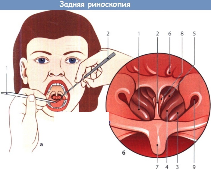 Endoscopy of the nasopharynx for children. How do they do it, price, reviews