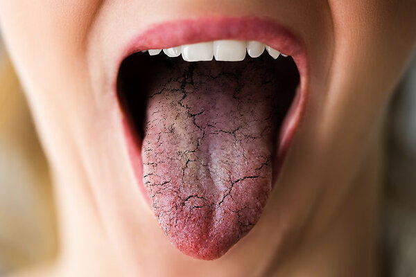 Dries up in the mouth of an elderly person. Reasons for what to do