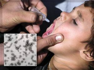 Gejala dan tanda poliomielitis pada anak-anak dan orang dewasa - pencegahan dan vaksinasi