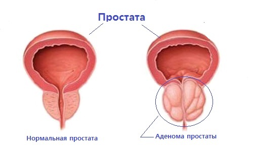 Structure and features of the functioning of the prostate
