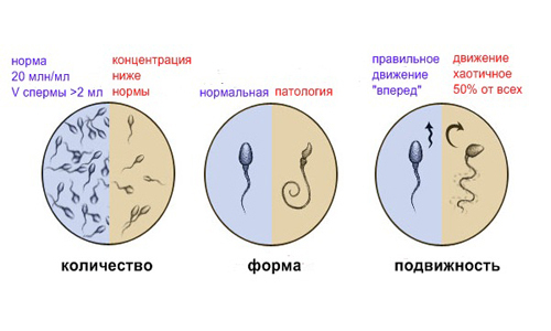 jakość spermy za pomocą spermogramu