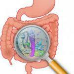 Dysbacteriosis of the intestine
